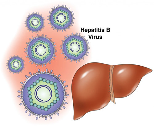 Viêm gan B là một loại bệnh học do virus hướng gan gây ra