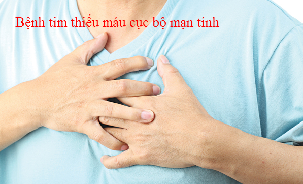 Tìm hiểu về bệnh thiếu máu cục bộ cơ tim mãn tính