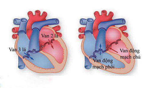 Tìm hiểu về căn bệnh hở van tim 2 lá