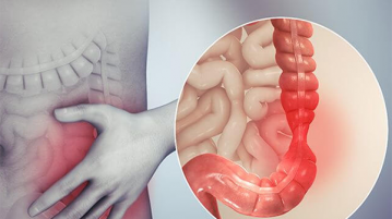 Dấu hiệu phổ biến của bệnh viêm đại tràng co thắt mạn tính