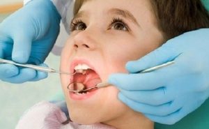 dieu-tri-viem-amidan-tre-em