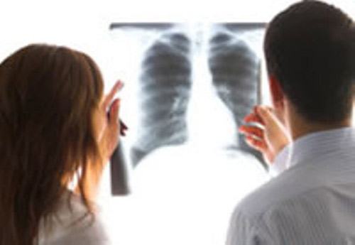 Bệnh ung thư phổi điều trị bằng cách nào?