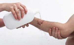 Rửa tay xà phòng cách sơ cứu vết thương khi bị chó cắn