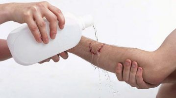 Rửa tay xà phòng cách sơ cứu vết thương khi bị chó cắn