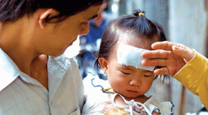 bac-si-khuyen-cao-can-than-di-ung-da-khi-dung-mieng-dan-ha-sot-cho-tre-em