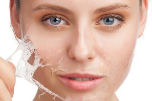 Xuất hiện nhiều mảng da khô trên cơ thể
