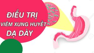 viem xung huyet hang vi da day